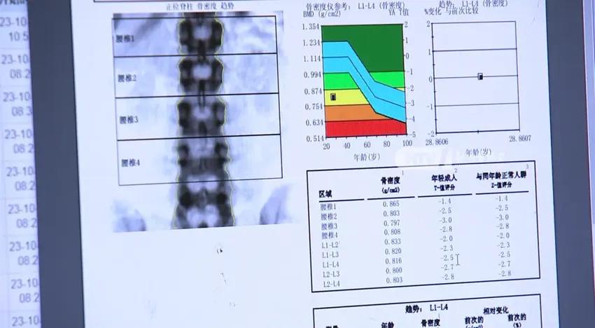 女子洗澡时滑倒进医院，结果查出这种病……每天喝3杯，连喝30年，问题那么大？