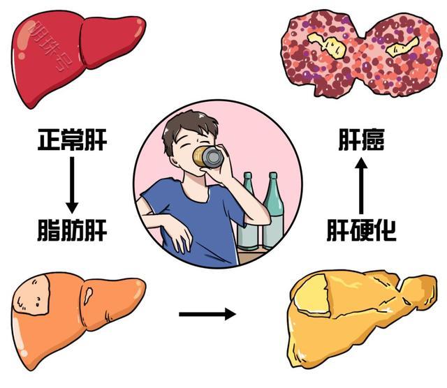 脂肪肝是如何形成的？有哪些危害？该如何消除？一文了解下