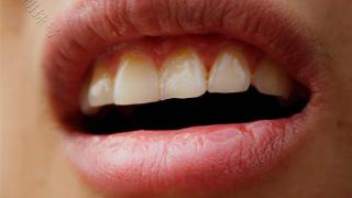孩子嘴唇经常起皮干裂？主要有三大原因，建议多了解下