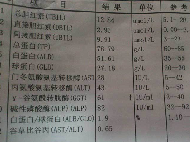 肝功能检查这4种指标偏高，可能是肝脏出现了问题