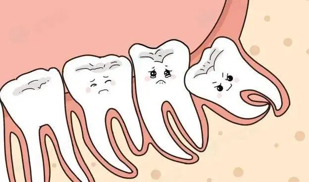 原来“拔智齿”也是有最佳年龄的？医生提醒：这6类人谨慎拔智齿