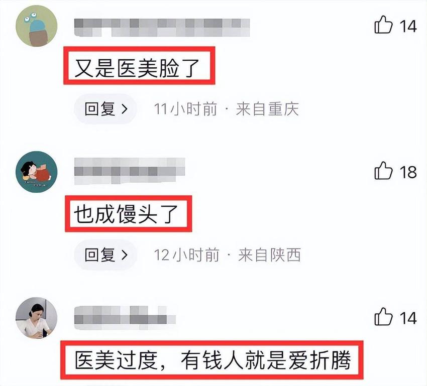 赵丽颖近照变化大，脸肿僵硬像蜡人，圆脸变成长脸被指整容失败