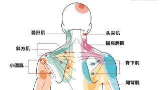 经常落枕是不是说明颈椎出了问题