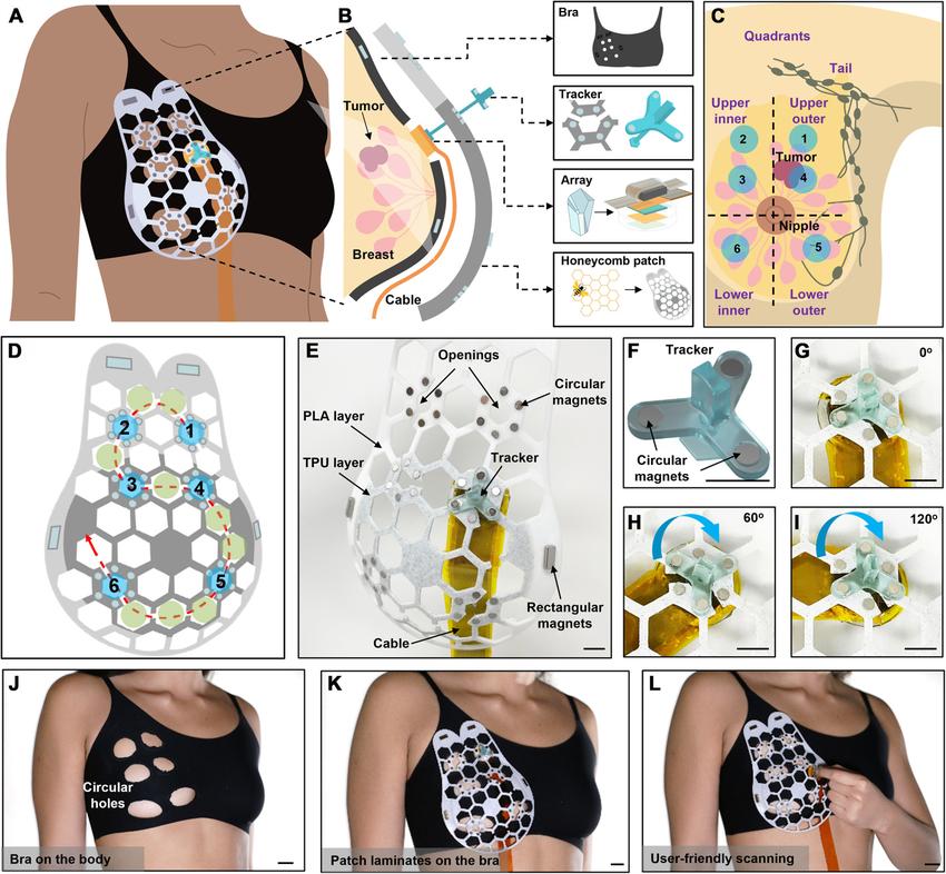 及早筛查乳腺肿瘤，科学家发明家用可穿戴超声波设备