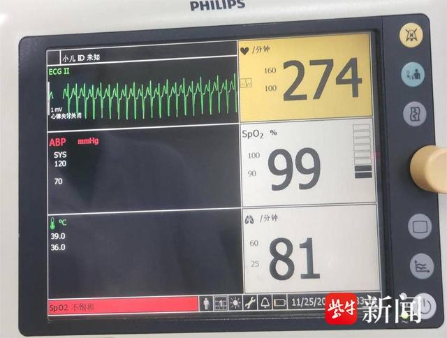 宝宝出生仅22天命悬一线，食道调博成功案例