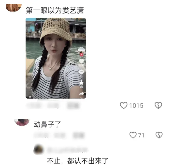 脸僵鼻子怪，嘴歪下巴尖，从金晨到柳岩，明星动脸后遗症都出来了