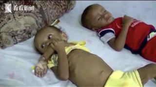 也门冲突近8年 已致超1.3万名妇女儿童伤亡