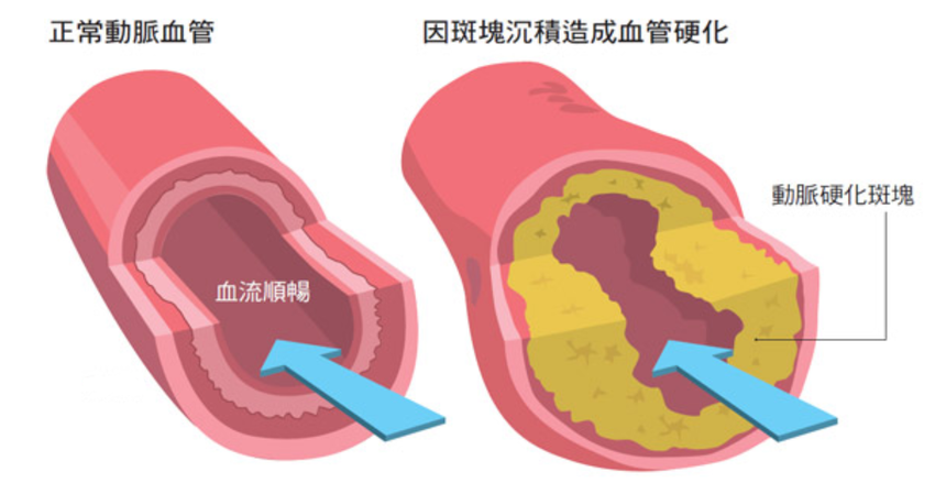 揭秘维生素C的神奇力量：你真的了解这个“生命之源”吗？