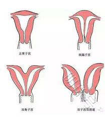 8个影响胚胎着床的宫腔因素，你知道几个？