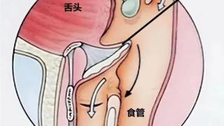 人类身上明显的缺陷：吃饭时发出声音会杀死自己