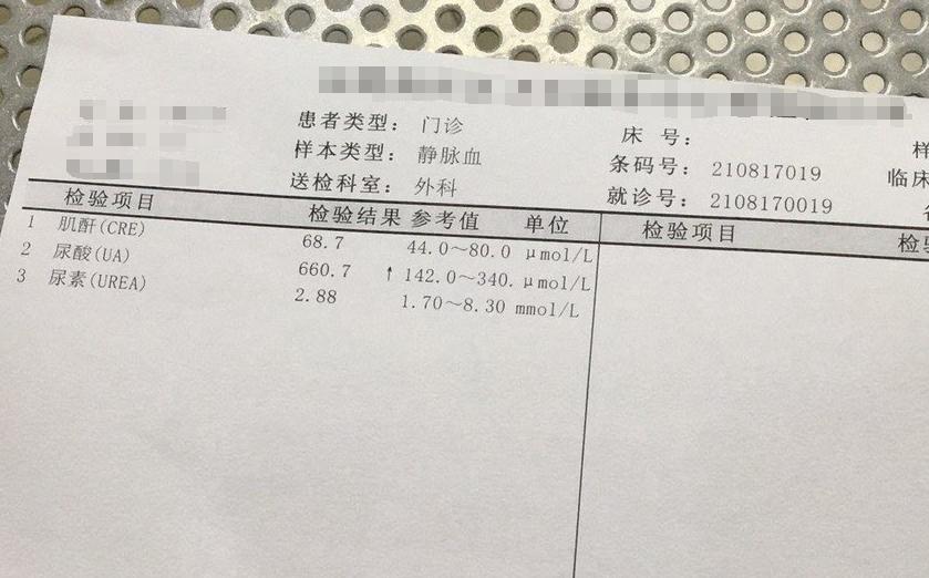 42岁代谢异常有痛风石患者，来武汉同普找痛风专家王巍2个疗程恢复健康