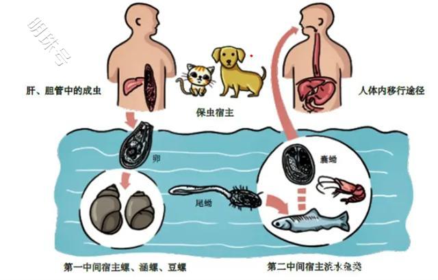 胆管癌的三个部位出现“警报”，医生表示要尽快检查