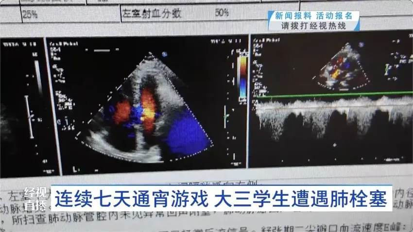 不到一个小时就会猝死！大学生突发凶险疾病 这些都是高危人群