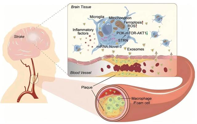 同济医院研究团队揭示外泌体miRNA Novel3在缺血性脑损伤中的关键作用
