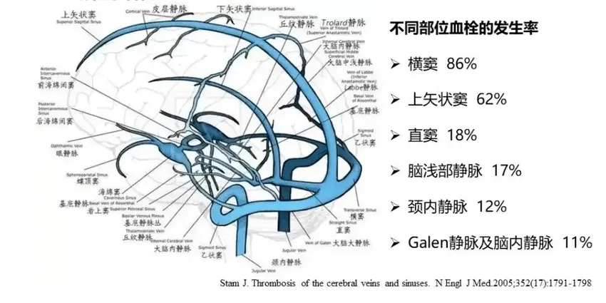 孕妇头痛，进了ICU，罪魁祸首竟是它！| 芳村医院