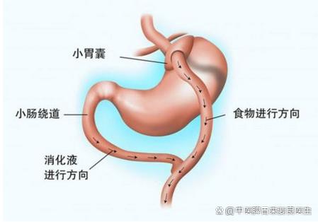 奥美拉唑服用多年不管用，治疗方向错了，不妨看看中医