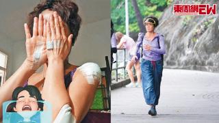 59岁TVB戏骨街头跑步出意外，摔到遍体鳞伤，紧急打破伤风针
