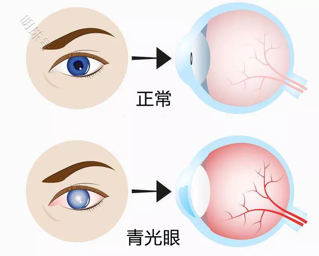 这样做，帮助降低手机带来的伤害，不妨学习下