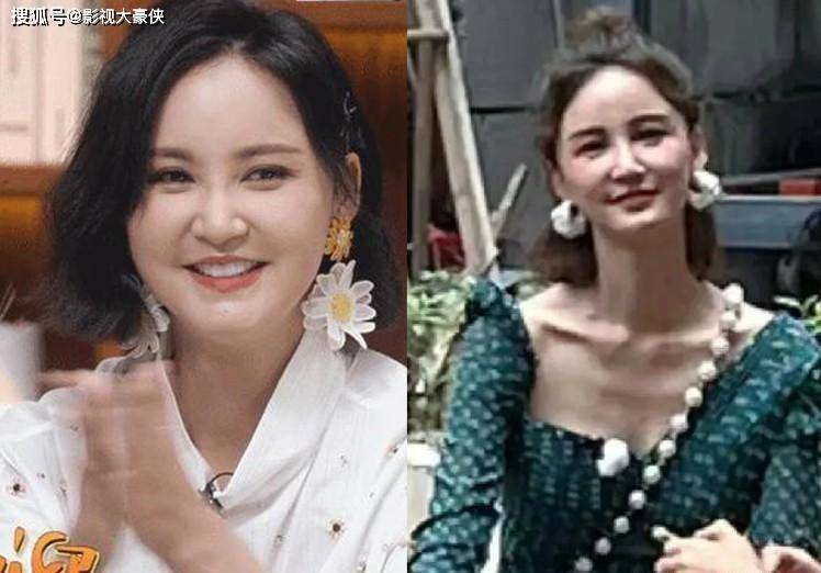 娱乐圈女星体重风波：过度瘦身背后的健康与审美挑战