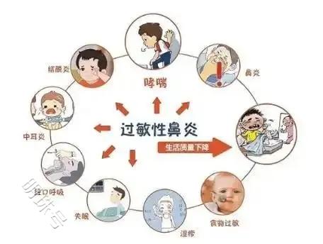 金博智慧:ADHD 伴过敏性鼻炎是先治过敏还是先治 ADHD