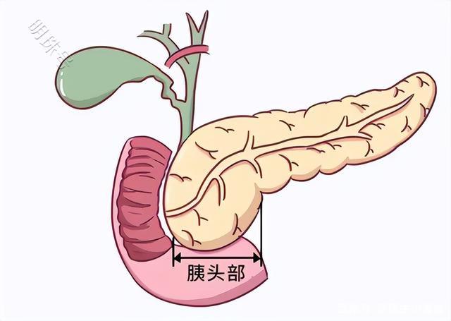 胰腺癌的发病率为什么这么高？一文揭晓答案