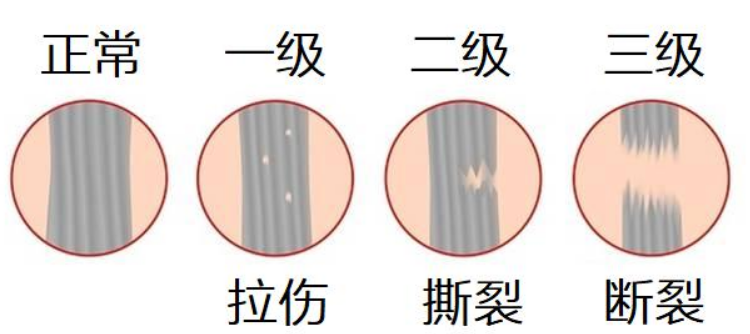 唐斯炮轰森林狼管理层：三级拉伤很长时间内都不会复出