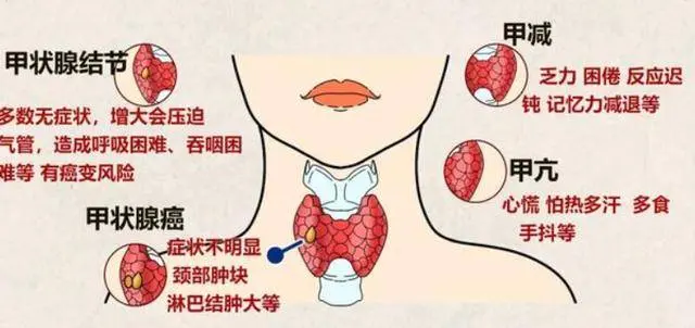 体内有病，脖子先知？提醒：若出现三种情况，早做癌筛查为妙