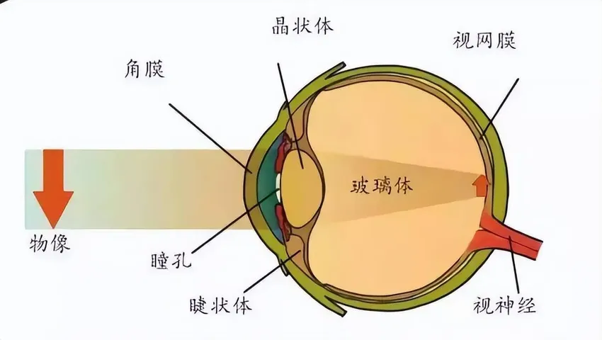 近视的人年纪大了之后，是视力逐渐改善，还是会同时得上老花眼？