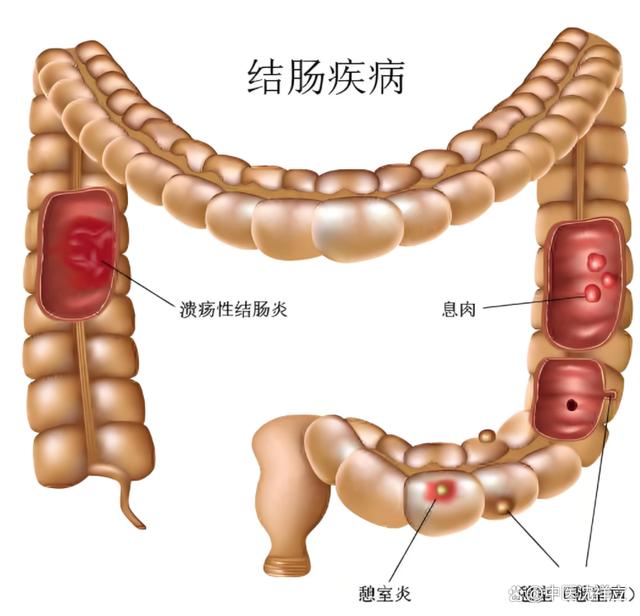 桑叶是个宝，这个夏天要用好，对付溃结有妙用