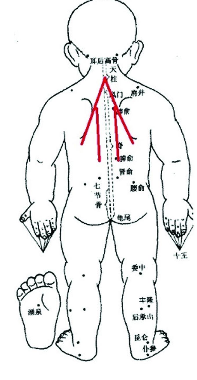 孩子发热不退久咳不愈 省中医院专家：可尝试“小儿推拿”