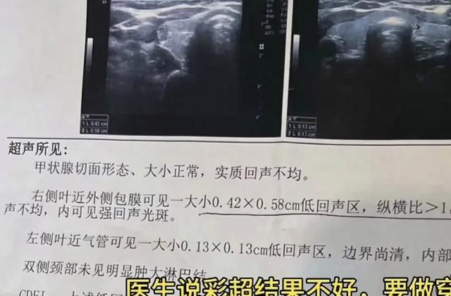 奇葩！女子相亲被对方气到住院，对方提牛奶去探望临走时又拿走了