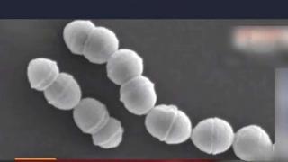 日本“食人菌”感染暴发，致死率超30%，飞沫就能传播