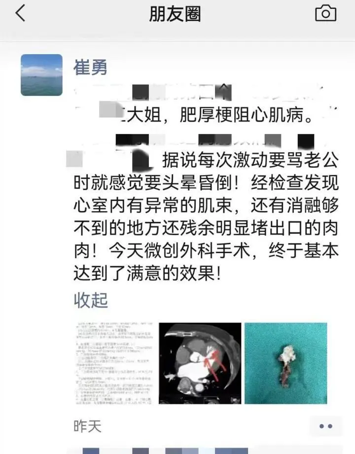 一和老公吵架，她就觉得天旋地转，像要晕倒……