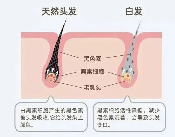 白发长在哪，病就从哪出？长在前额、两鬓、后脑勺，分别代表啥？