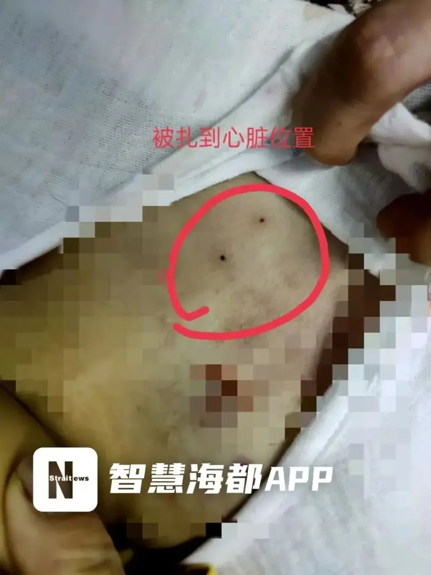 4岁女童命丧手术台，家属称规培生穿刺操作失当扎破心脏，致女儿殒命