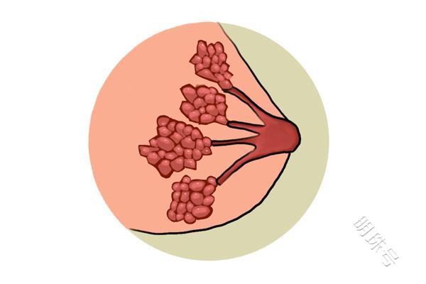 什么饮食会增加乳腺结节发病率？建议了解下