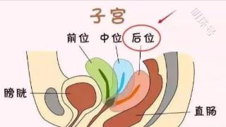 子宫后位会影响怀孕吗？这些小方法让你轻松受孕！