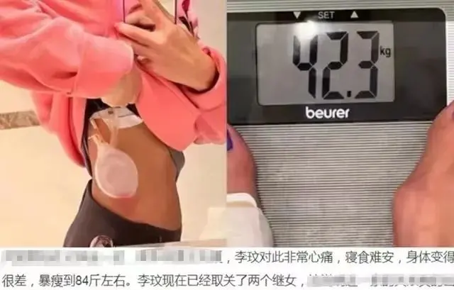 李玟轻生前内幕细节曝光：求生欲极强！家人强烈要求尸检，暗示凶手就是他