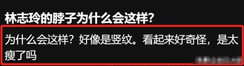 50岁林志玲现身日本：医美痕迹太严重像“换脸”？网友直呼认不出