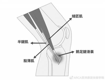 半月板手术后 为啥疼得更厉害了