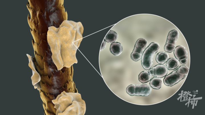 冲上热搜！长期湿发睡觉染上这种菌会致癌？皮肤科医生：两方面的危害最大