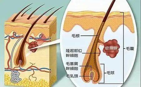 酒糟鼻是怎么一回事