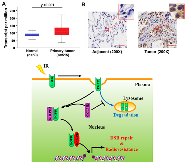 我国科学家发现肺腺癌放射抗性形成的新机制