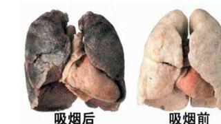 危害比香烟高7倍，在多国都已被禁，但是中国人却还把它当宝贝！