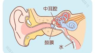 郑州民生耳鼻喉医院：耳朵进水了怎么办？