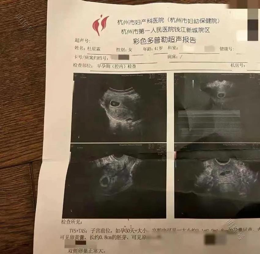 太牛了！张纪中72岁再当爹，透露怀孕秘诀，网友的评论把人笑翻