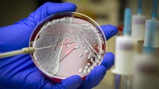 人工智能显神威，一个半小时筛选出能杀死超级细菌的新型抗生素