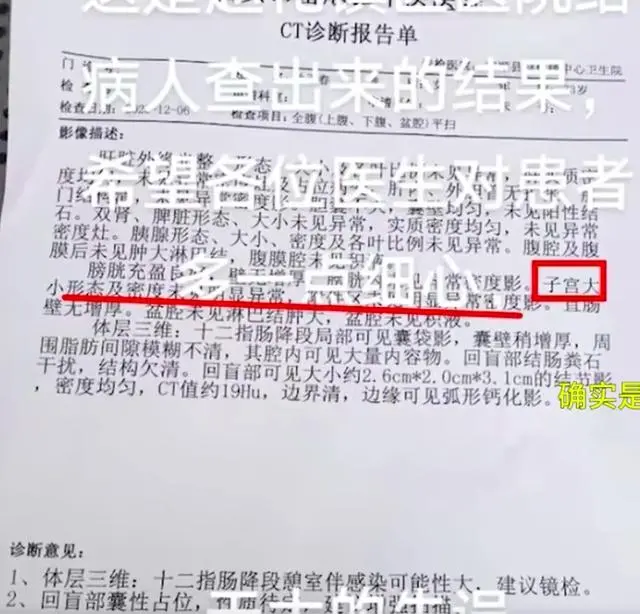 男子CT报告出现子宫检查结果？院方：因该男子名字像女士，登记性别失误；卫生局回应：将尽快调查