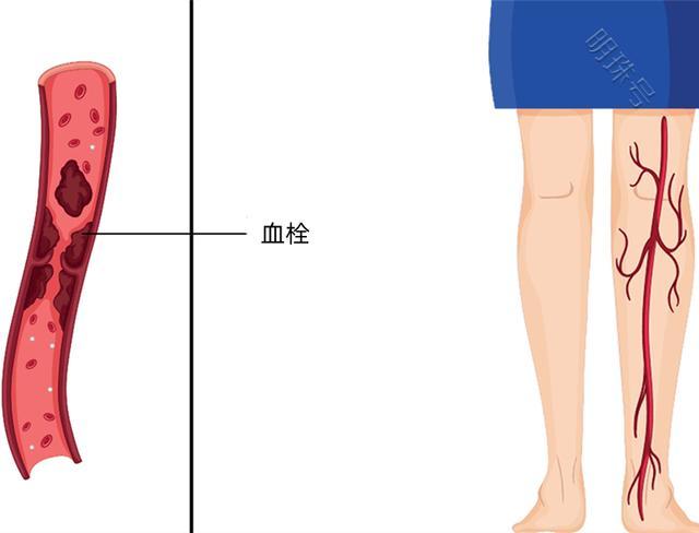 脚，脚踝，小腿莫名肿胀，老年人要注意这几个问题