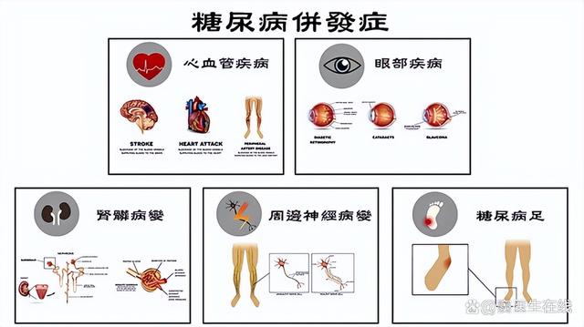 老年人健康控糖，需要做到以下几点